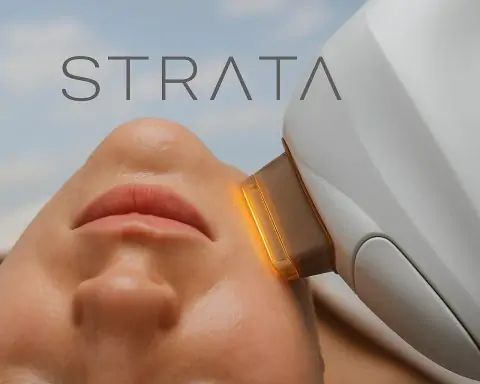 Strata Skin Sciences (SSKN) Stock Surges on Laser-Therapy Breakthrough – Buy, Hold or Sell?
