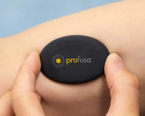 Profusa (PFSA) Stock Skyrockets 36% on Milestone News – Can This Biotech Sensor Play Rebound?