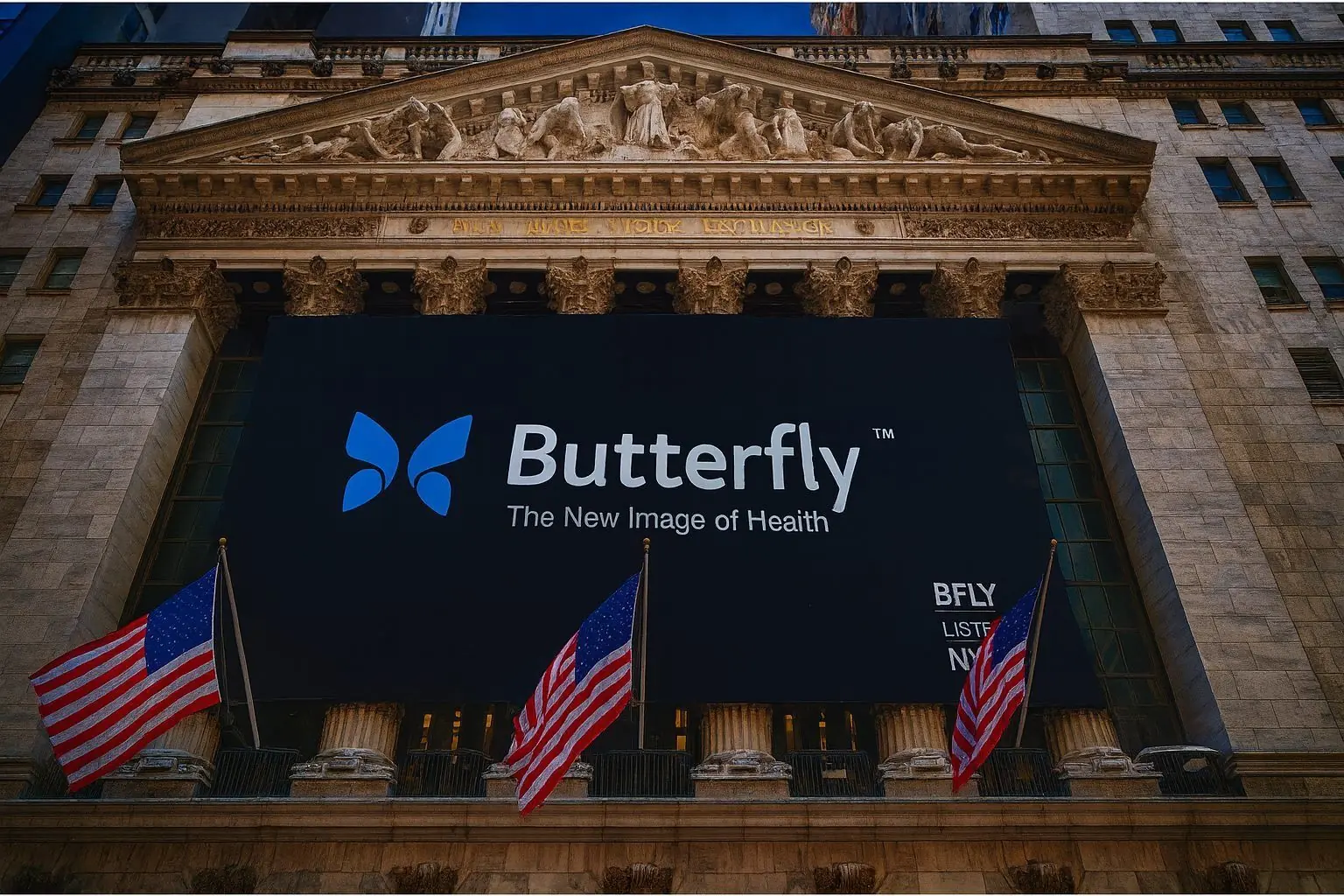 BFLY Stock Today: Butterfly Network Jumps on Licensing Deal, Insider Buying and AI Momentum (Nov. 24, 2025)