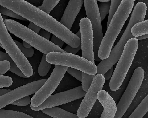 E. coli Alert: France Recalls Reblochon de Savoie AOP Sold at E.Leclerc, Grand Frais and Fresh — What to Check Now (November 10, 2025)