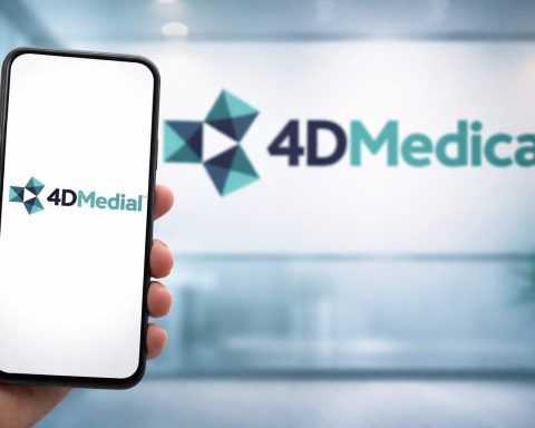 4DMedical shares jump on UC San Diego Health CT:VQ rollout as market eyes next catalyst