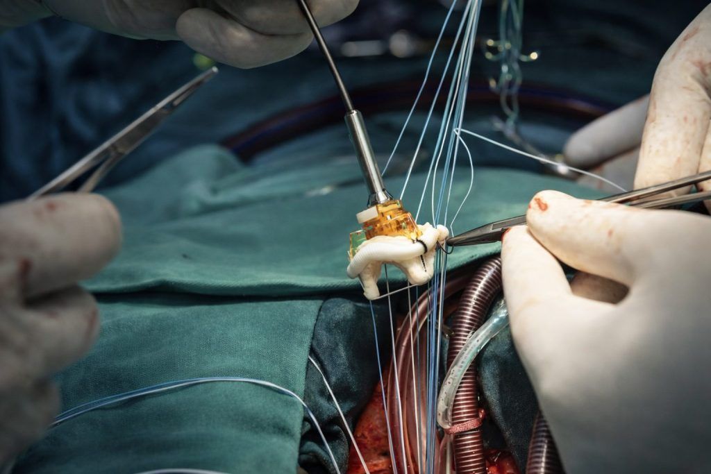 FTC blocks Edwards’ JenaValve deal — what EW stock investors watch next week