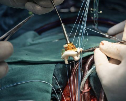 FTC blocks Edwards’ JenaValve deal — what EW stock investors watch next week