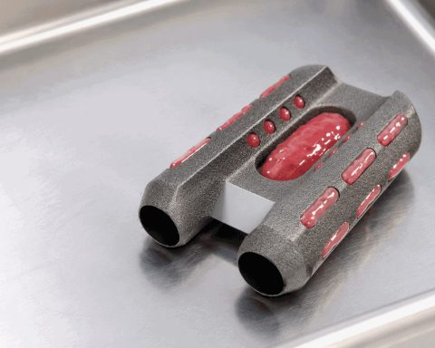 Tenon Medical Shares Edge Down 0.4% as $3 Million Placement Raises Dilution Risk
